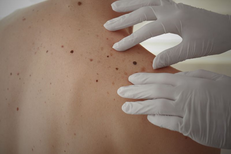 Cirurgia Convencional ou Tradicional